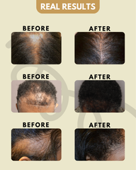 Strandzhairgro Hair Growth Oil Serum